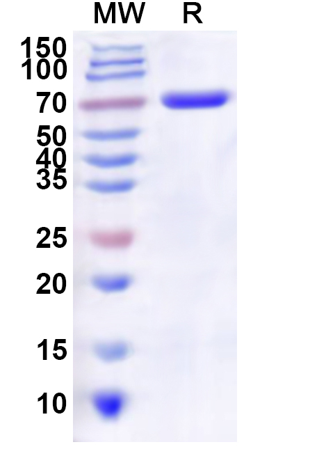 SDS-PAGE for Recombinant Human ATP11A Protein, N-His