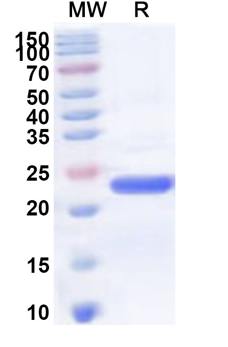 SDS-PAGE for Recombinant Human ATP5F1E Protein, N-His-KSI