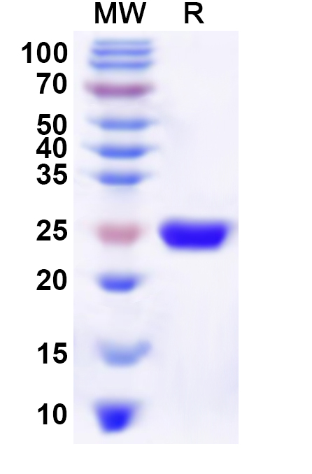 SDS-PAGE for Recombinant Human ATP8A1 Protein, N-His
