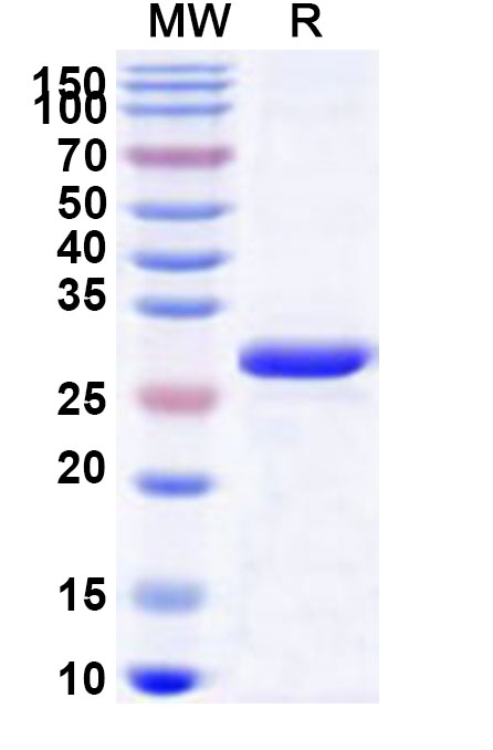 SDS-PAGE for Recombinant Human ATP8B3 Protein, N-His