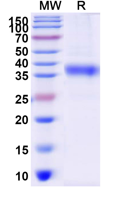 SDS-PAGE for Recombinant Human AURKA Protein, N-His
