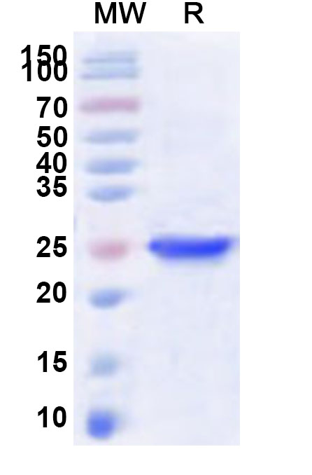 SDS-PAGE for Recombinant Human AVPR1B Protein, N-His-KSI