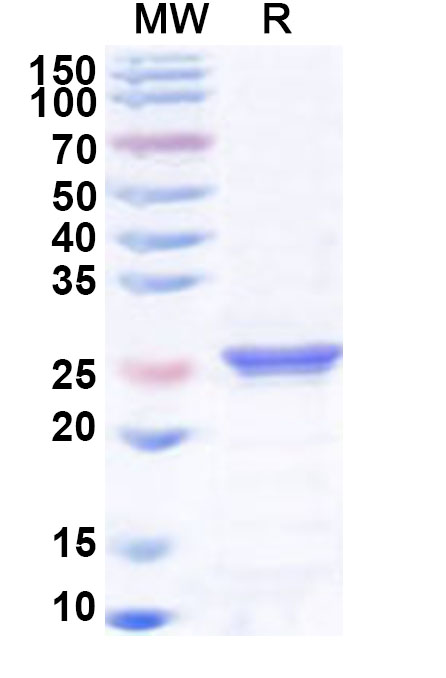 SDS-PAGE for Recombinant Human BAG2 Protein, N-His
