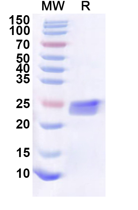 SDS-PAGE for Recombinant Human BBIP1 Protein, N-His-KSI