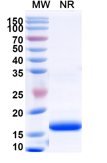 SDS-PAGE for Recombinant Human BCHE, N-His