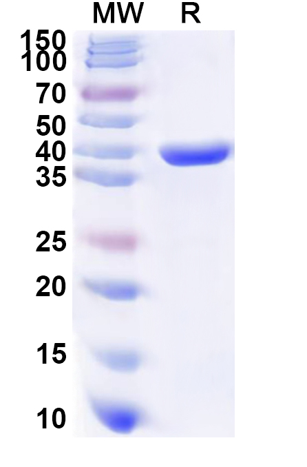 SDS-PAGE for Recombinant Human BCKDHB Protein, N-His