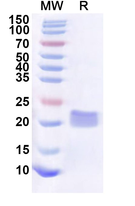 SDS-PAGE for Recombinant Human BCL9 Protein, N-His-KSI