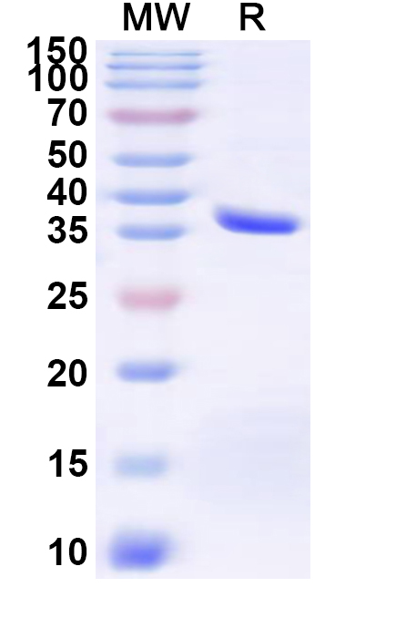 SDS-PAGE for Recombinant Human BEST1 Protein, N-GST & C-His