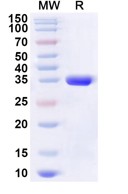 SDS-PAGE for Recombinant Human BEX3 Protein, N-His-KSI