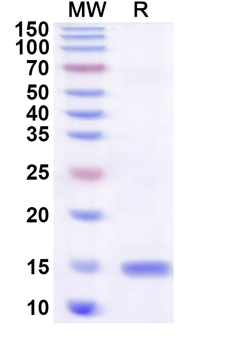 SDS-PAGE for Recombinant Human BLOC1S2 Protein, N-His