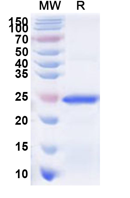 SDS-PAGE for Recombinant Human BNC2 Protein, N-His