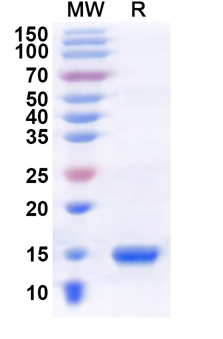 SDS-PAGE for Recombinant Human BRDT Protein, N-His
