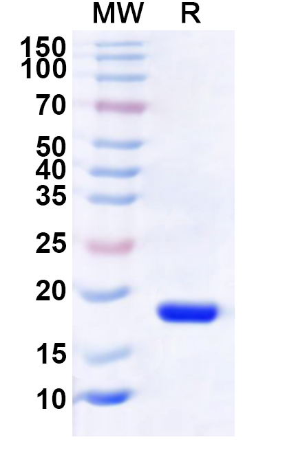 SDS-PAGE for Recombinant Human BRMS1L Protein, N-His