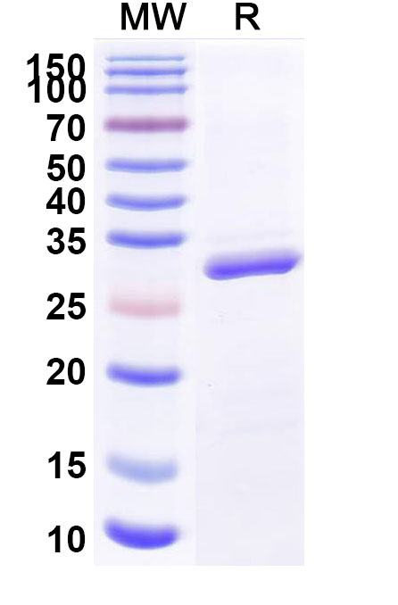 SDS-PAGE for Recombinant Human BTD, N-His