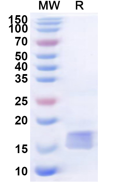 SDS-PAGE for Recombinant Human BTLA Protein, N-His