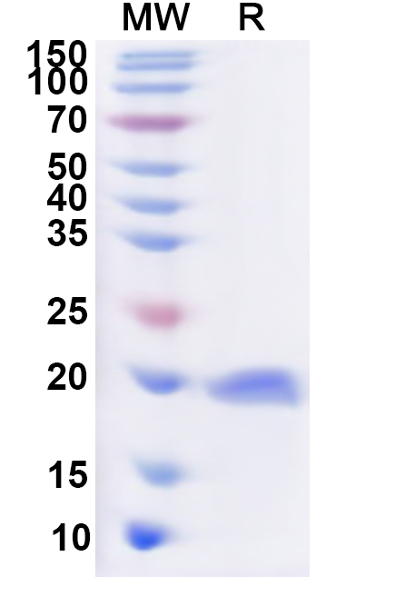 SDS-PAGE for Recombinant Human BUD31 Protein, N-His