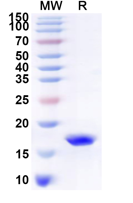 SDS-PAGE for Recombinant Human C1D Protein, N-His