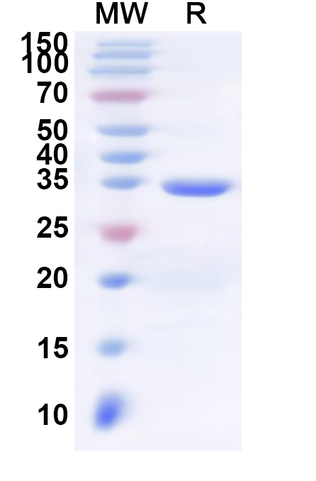 SDS-PAGE for Recombinant Human C3AR1 Protein, N-His-KSI