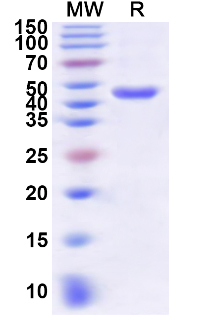 SDS-PAGE for Recombinant Human C4BPA Protein, N-His