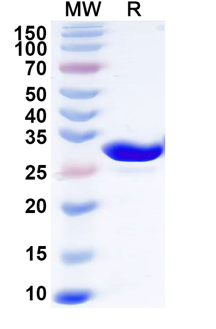 SDS-PAGE for Recombinant Human CA2 Protein, N-His