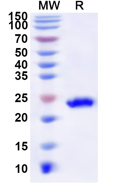 SDS-PAGE for Recombinant Human CABP4 Protein, N-His