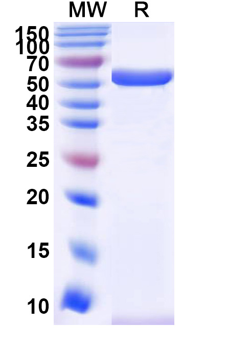 SDS-PAGE for Recombinant Human CAP2 Protein, N-His