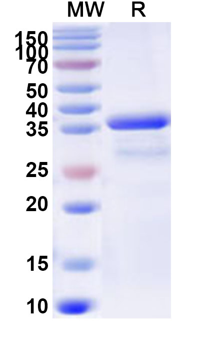 SDS-PAGE for Recombinant Human CARD18 Protein, N-GST & C-His