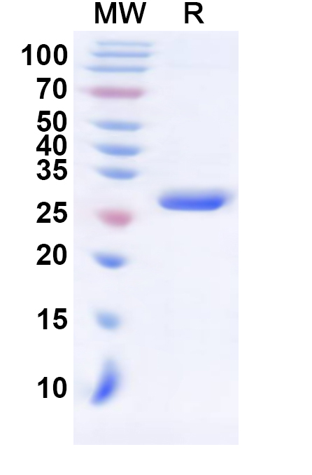 SDS-PAGE for Recombinant Human CARTPT Protein, N-GST & C-His