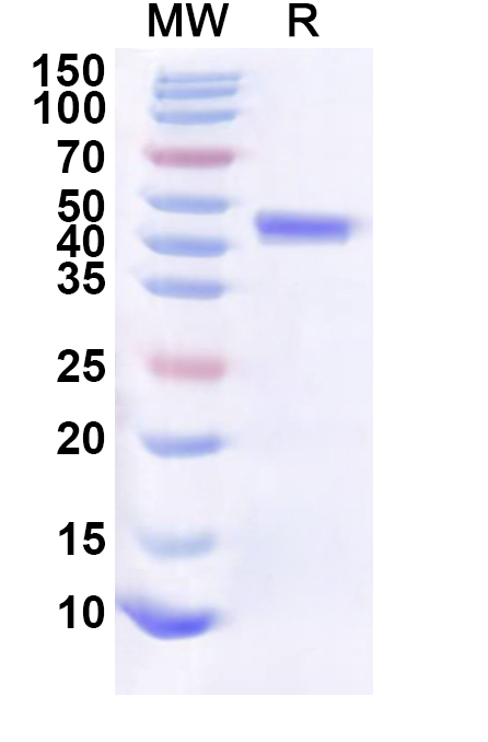 SDS-PAGE for Recombinant Human CASC3 Protein, N-His-KSI