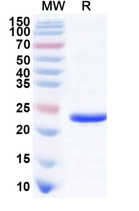 SDS-PAGE for Recombinant Human CBFB Protein, N-His