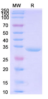 SDS-PAGE for Recombinant Human CBR1, N-His