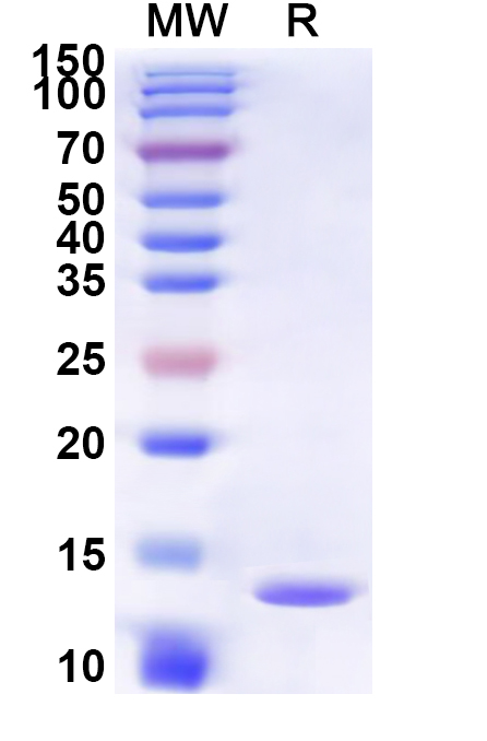 SDS-PAGE for Recombinant Human CCKAR Protein, N-His-KSI