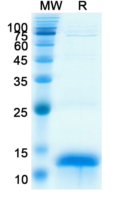SDS-PAGE for Recombinant Human CCNB1, N-His