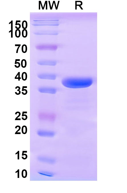 SDS-PAGE for Recombinant Human CD148/PTPRJ Protein, N-His