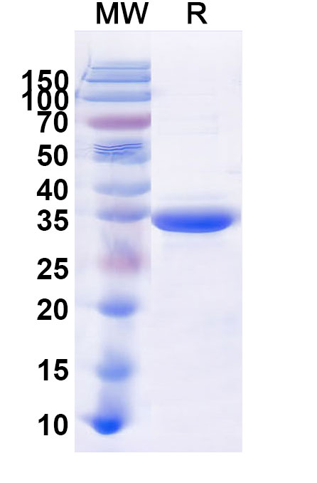 SDS-PAGE for Recombinant Human CD156b/ADAM17, N-His