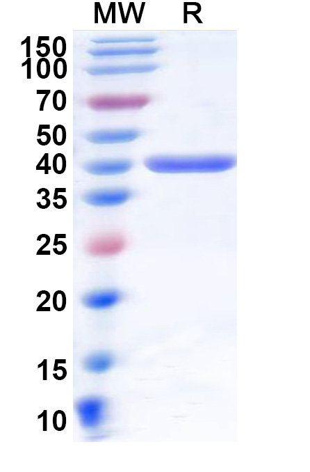 SDS-PAGE for Recombinant Human CD218b/IL18RAP, N-His