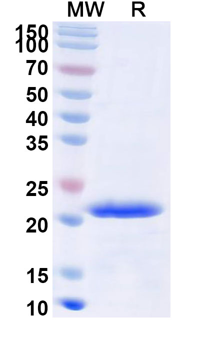 SDS-PAGE for Recombinant Human CD224/GGT1 Protein, N-His