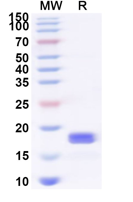 SDS-PAGE for Recombinant Human CD300LB Protein, N-His
