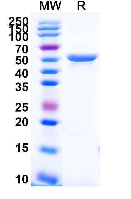 SDS-PAGE for Recombinant Human CD49f/ITGA6 Protein, N-His