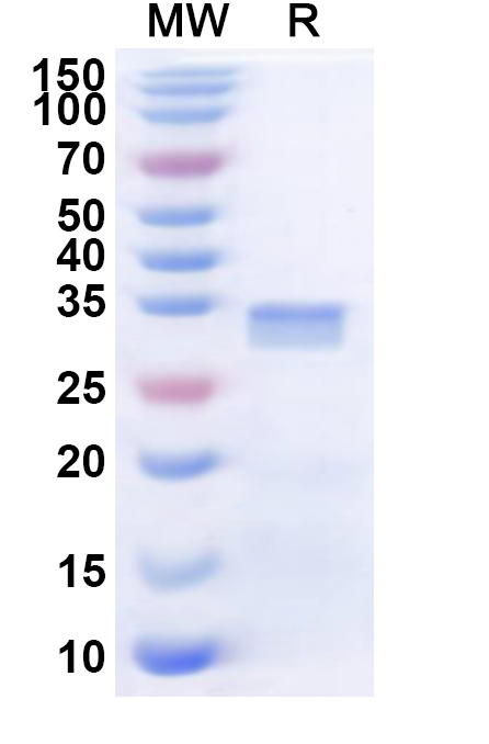 SDS-PAGE for Recombinant Human CDC42BPG Protein, N-His