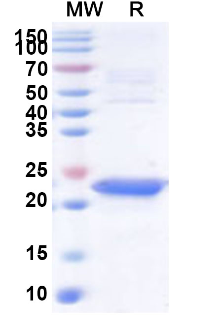 SDS-PAGE for Recombinant Human CDC73 Protein, N-His