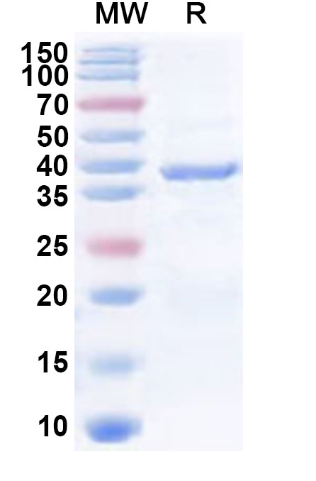 SDS-PAGE for Recombinant Human CDK10 Protein, N-His