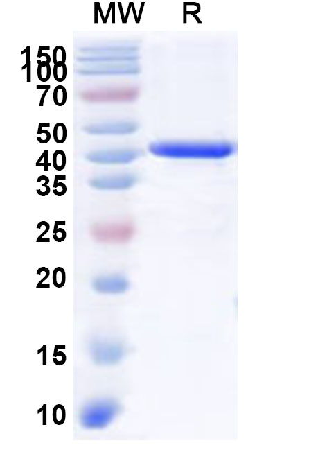 SDS-PAGE for Recombinant Human CDK18 Protein, N-His