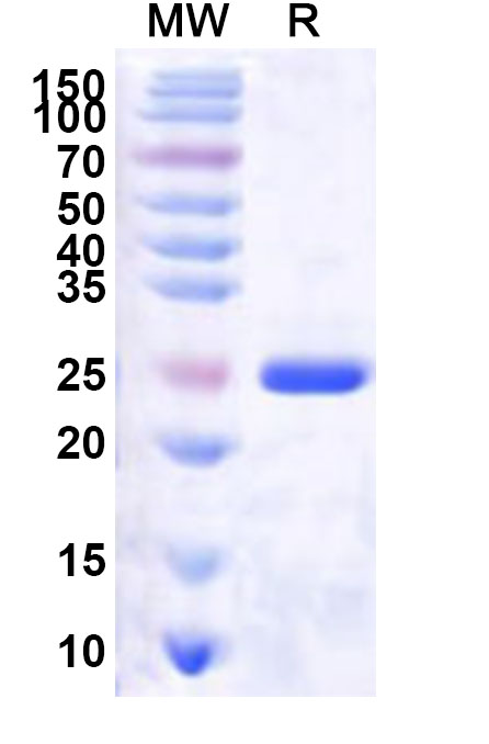 SDS-PAGE for Recombinant Human CDK2AP2 Protein, N-His-KSI