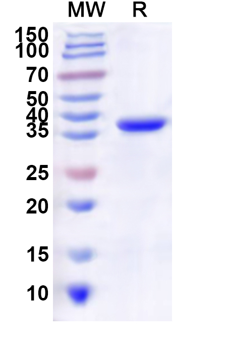 SDS-PAGE for Recombinant Human CDK3 Protein, N-His