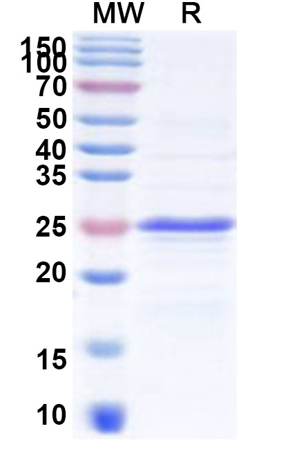 SDS-PAGE for Recombinant Human CDSN Protein, N-His-KSI