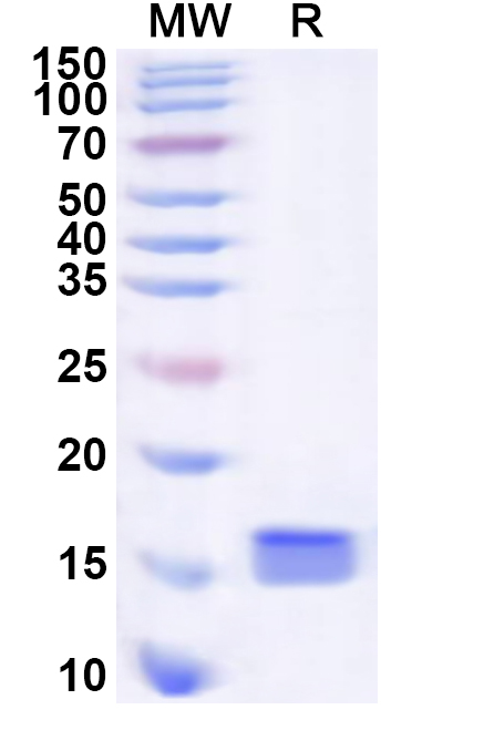 SDS-PAGE for Recombinant Human CENPC Protein, N-His