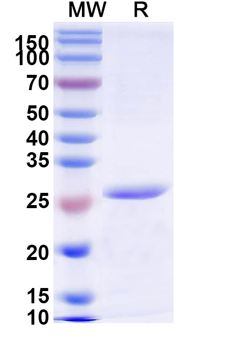 SDS-PAGE for Recombinant Human CFB Protein, N-His