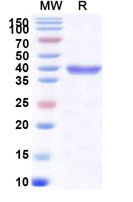 SDS-PAGE for Recombinant Human CHMP4B Protein, N-His-SUMO&C-Strep