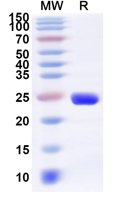 SDS-PAGE for Recombinant Human CHN2 Protein, N-His